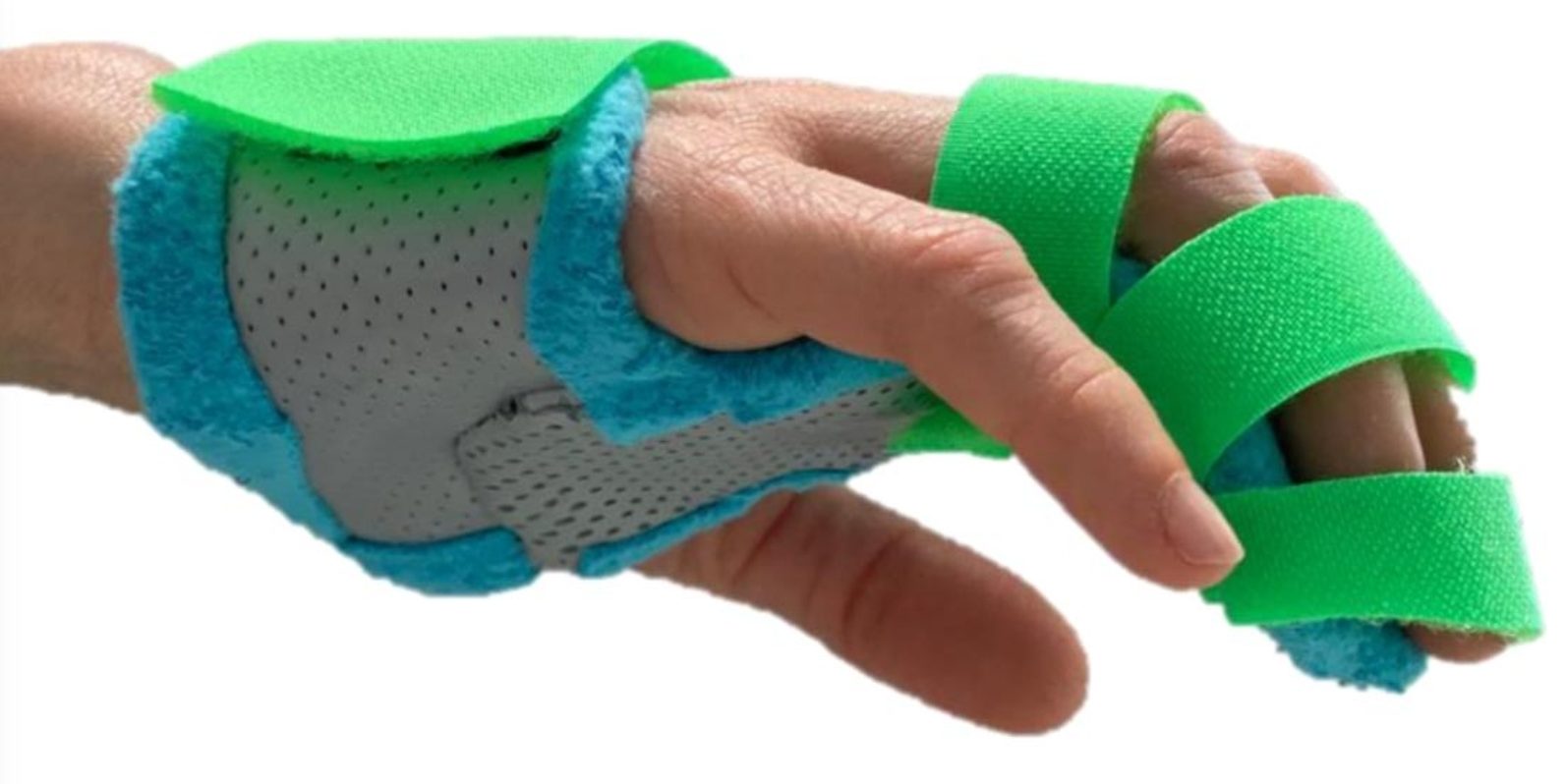 Tutore termoplastico personalizzato per la mano