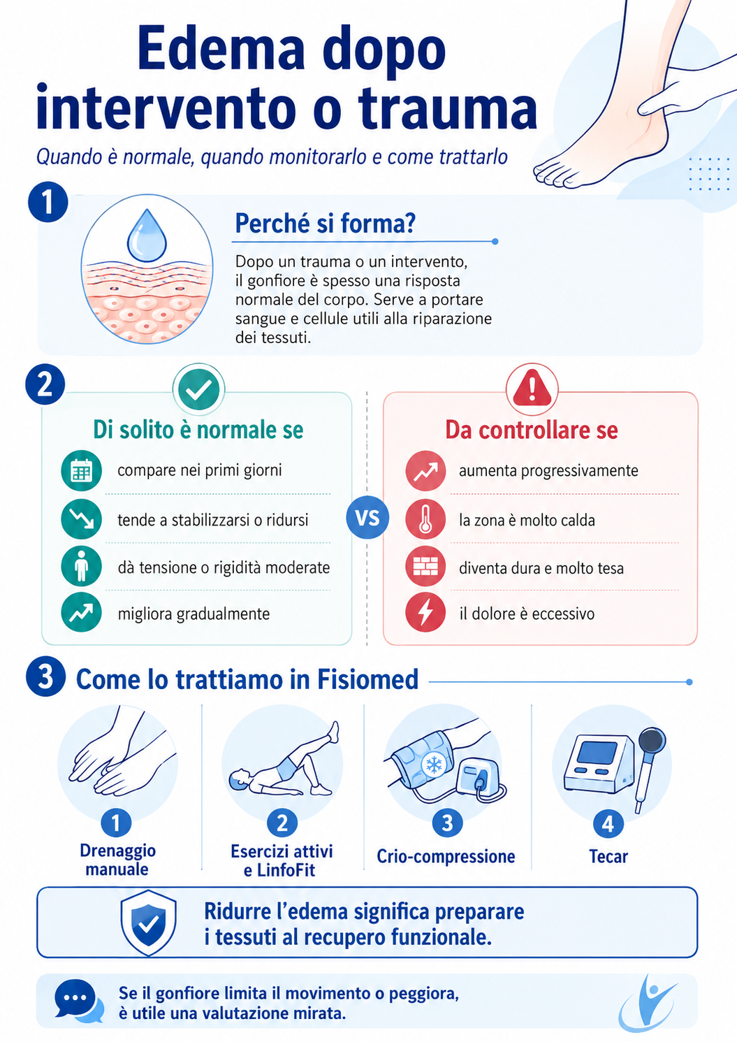 Infografica sull’edema dopo intervento chirurgico o trauma: quando il gonfiore è normale, quando monitorarlo e come trattarlo con fisioterapia a Fisiomed Sanremo.