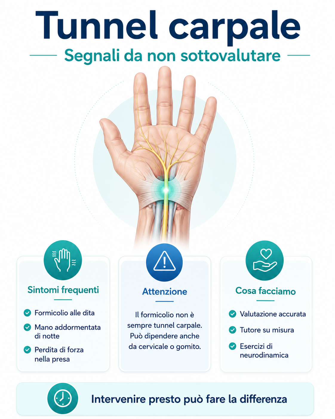 Infografica sulla sindrome del tunnel carpale con sintomi principali, formicolio alla mano e trattamento conservativo con tutore ed esercizi di neurodinamica.